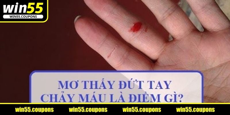 Nằm mơ thấy đứt tay hé lộ những bí mật tiềm ẩn